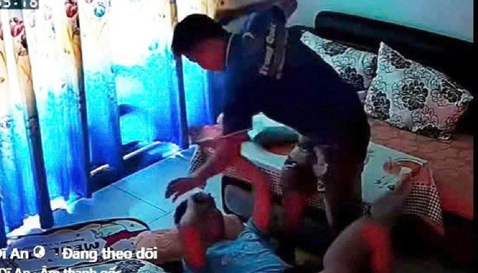 Bé trai được gia đình đưa đến bệnh viện kiểm tra sức khỏe sau khi bị cha dượng đánh nhiều lần vào vùng đầu, mặt.