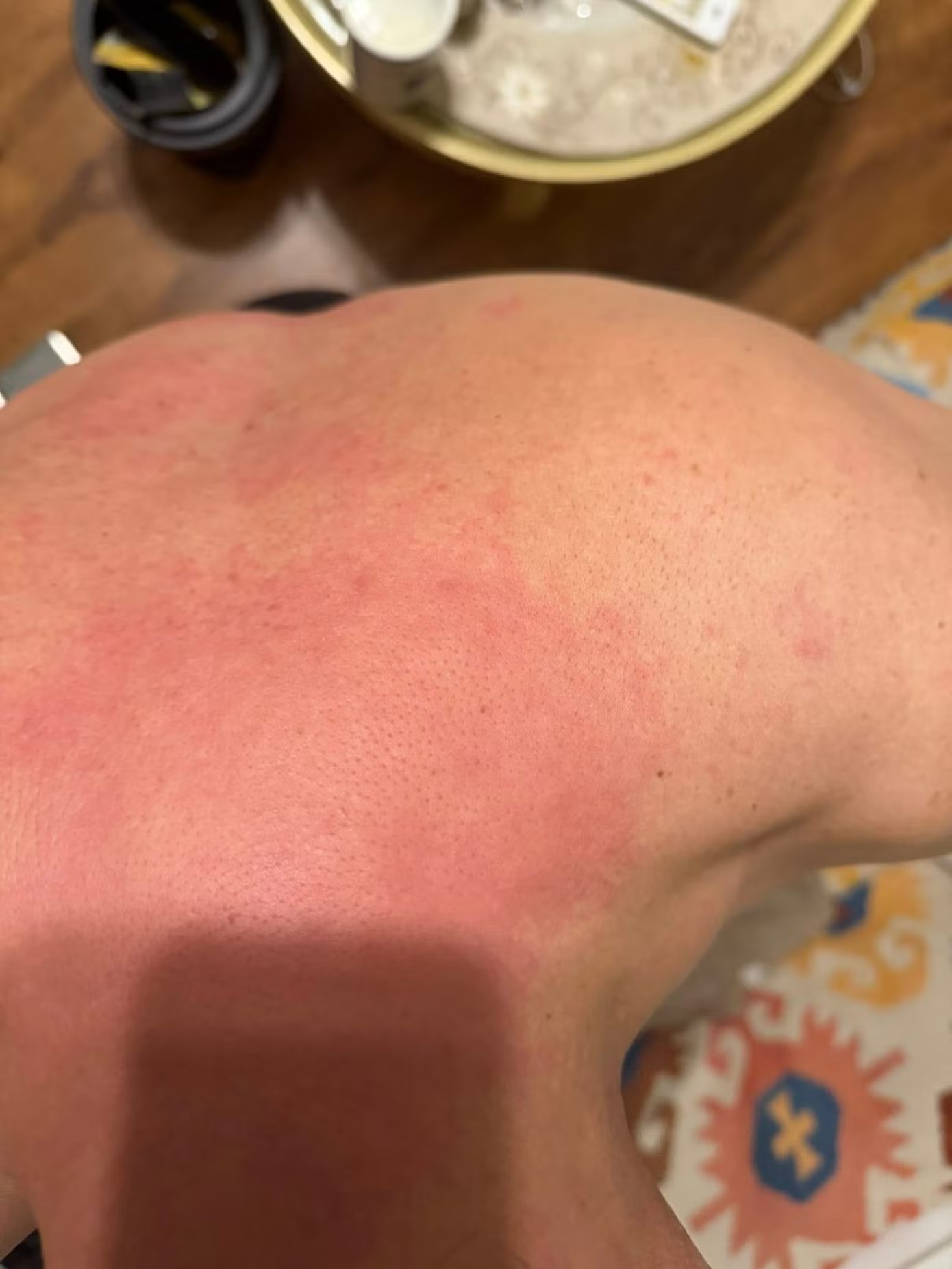 NSƯT Chí Trung mắc bệnh lạ - 2