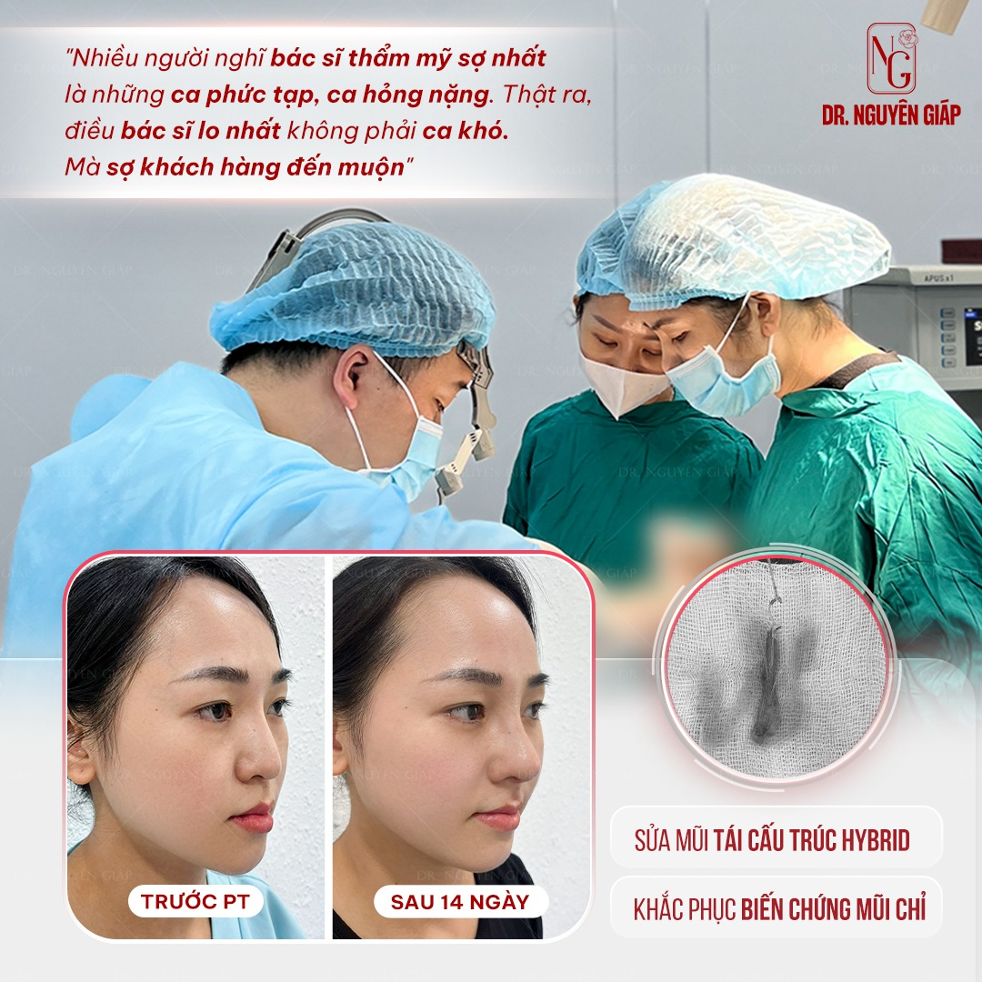 Bác sĩ Trần Nguyên Giáp và cách tiếp cận nâng mũi cấu trúc Hybrid từ tiêu chuẩn quốc tế - 3