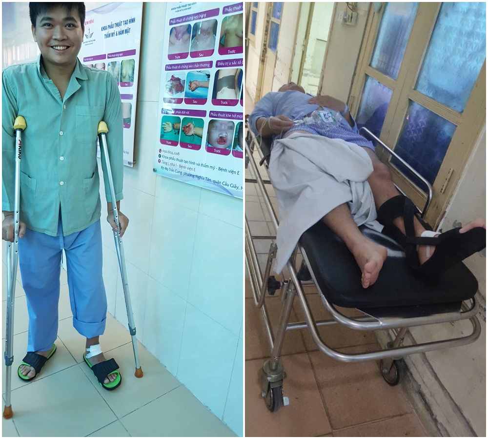 Bác sĩ Khánh liên tiếp gặp chấn thương ở chân trái khiến việc đi lại gặp nhiều khó khăn.