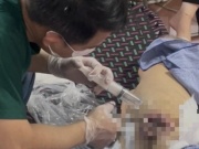 Xâm nhập cơ sở ‘CHUA BENH BANG NUOC’ trị ung thư