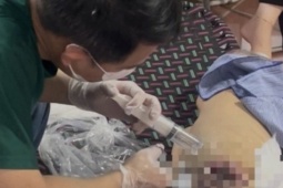 Xâm nhập cơ sở ‘CHUA BENH BANG NUOC’ trị ung thư