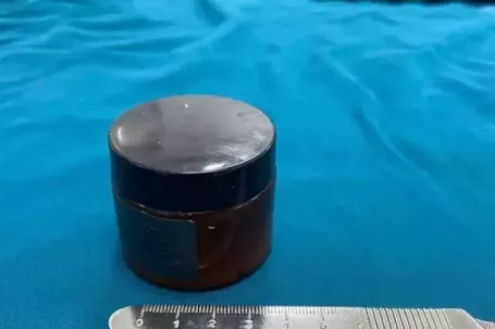 Người đàn ông hoảng loạn khi hũ mỹ phẩm chui tọt vào trực tràng