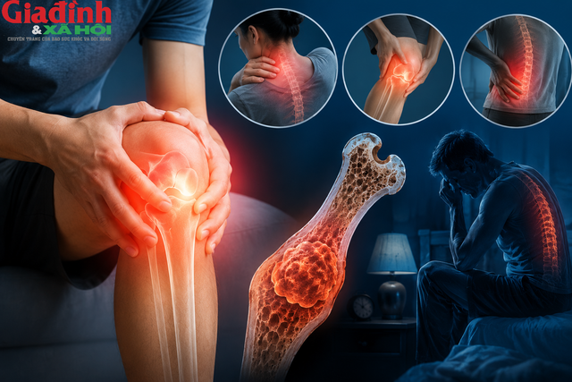 Nhiều trường hợp ung thư xương ban đầu chỉ xuất hiện triệu chứng đau nhức giống bệnh xương khớp thông thường.