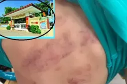 Học sinh lớp 1 bị bạn đánh hội đồng, phụ huynh bức xúc vì con phải chuyển lớp