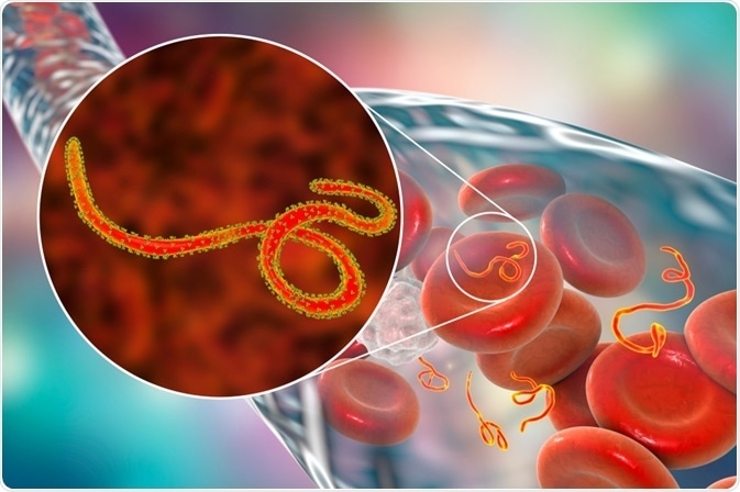 Đợt dịch hiện nay ở Cộng hòa Dân chủ Congo liên quan tới chủng Bundibugyo, một biến thể Ebola hiếm gặp và nguy hiểm do hiện chưa có vaccine hay thuốc điều trị đặc hiệu. (Ảnh minh họa)