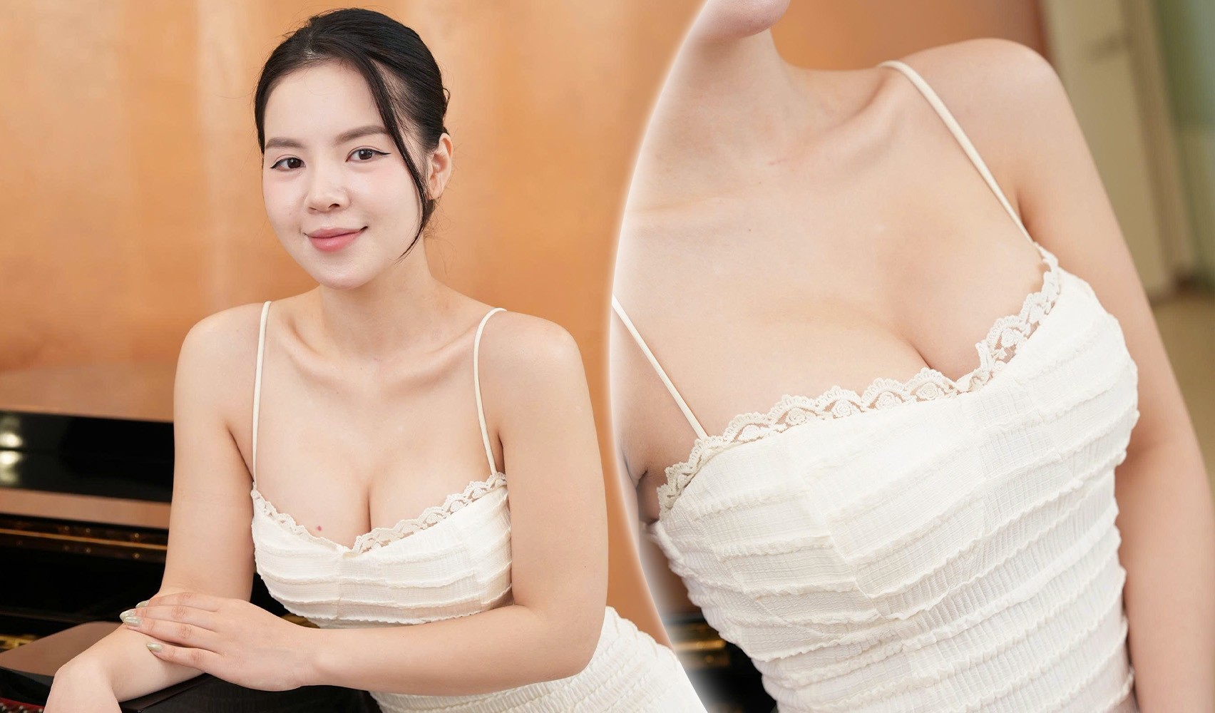 Sa trễ tuyến vú là tình trạng phổ biến ở phụ nữ và có thể cải thiện bằng phẫu thuật tạo hình theo chuẩn y khoa.