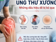 Đau xương kéo dài, đau nhiều về đêm: Bác sĩ cảnh báo dấu hiệu ung thư xương dễ bị bỏ qua
