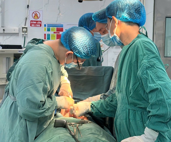 Các bác sĩ phẫu thuật khẩn lấy 6 mảnh dao lam trong đại tràng nữ bệnh nhân. Ảnh: TTYT khu vực Thuận An