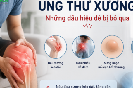 Đau xương kéo dài, đau nhiều về đêm: Bác sĩ cảnh báo dấu hiệu ung thư xương dễ bị bỏ qua