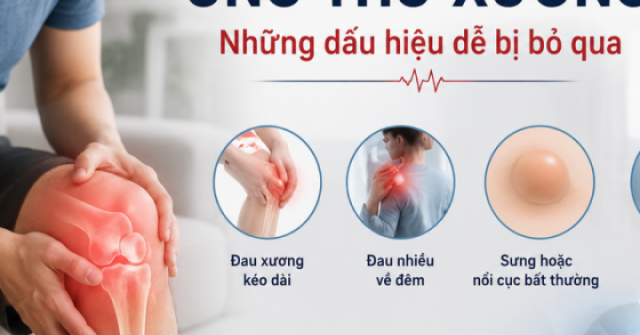 Đau xương kéo dài, đau nhiều về đêm: Bác sĩ cảnh báo dấu hiệu ung thư xương dễ bị bỏ qua