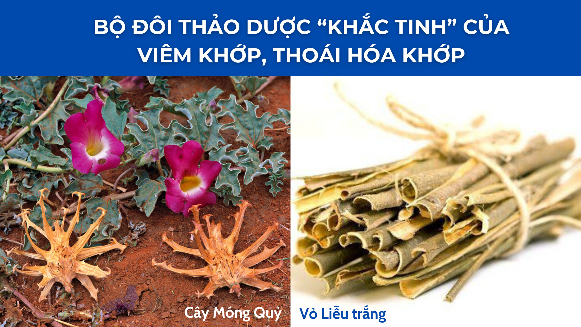 6 thói quen âm thầm “rút ngắn tuổi thọ” xương khớp - Nhiều người mắc phải! - 5