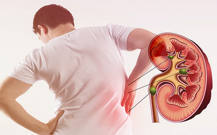 Khi chức năng thận suy giảm, nguy cơ tăng huyết áp, rối loạn chuyển hóa cũng tăng theo.