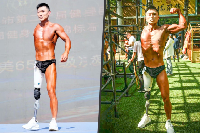 Vận động viên khuyết tật Liu Xinju. Ảnh: Douyin