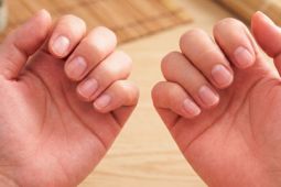 Nếu có đủ 6 thứ trên bàn tay thì xin chúc mừng! Thận của bạn khả năng cao vẫn còn rất khỏe