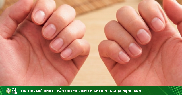 Nếu có đủ 6 thứ trên bàn tay thì xin chúc mừng! Thận của bạn khả năng cao vẫn còn rất khỏe