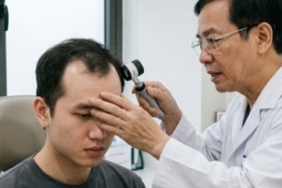 Người trẻ rụng tóc, hói đầu vì những thói quen tưởng vô hại