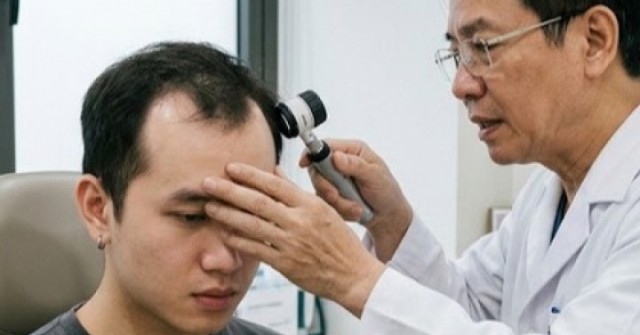 Người trẻ rụng tóc, hói đầu vì những thói quen tưởng vô hại