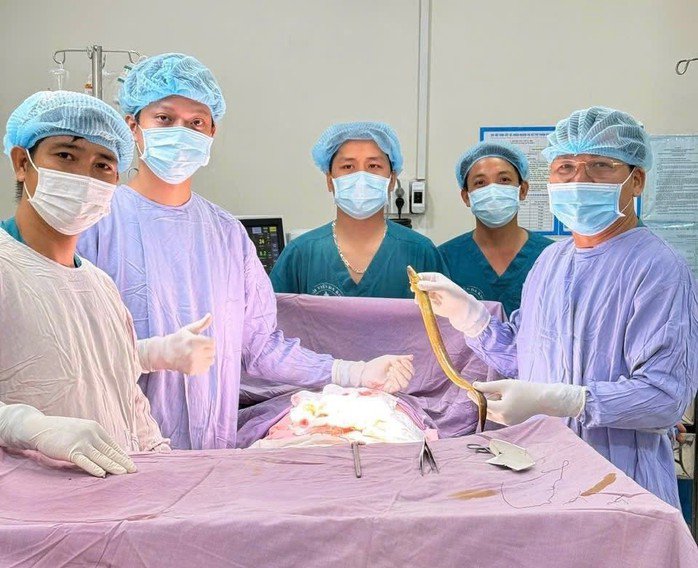 Các y bác sĩ thực hiện ca phẫu thuật gắp con lươn ra từ trong ổ bụng bệnh nhân. (Ảnh: BVĐK Thống Nhất Đồng Nai)