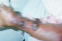 Vì sao WHO đánh giá nguy cơ Ebola vào Việt Nam ở mức thấp?