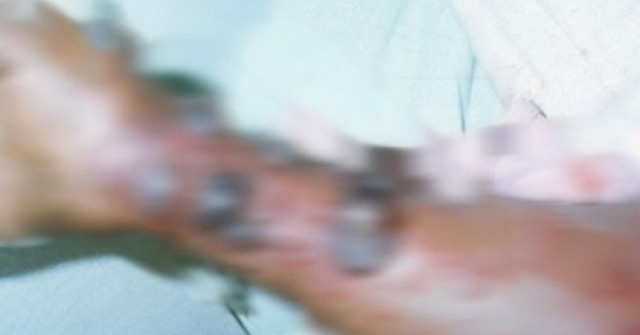 Vì sao WHO đánh giá nguy cơ Ebola vào Việt Nam ở mức thấp?