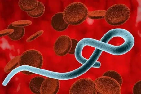 Nguy cơ bệnh Ebola xâm nhập Việt Nam qua đường du lịch quốc tế