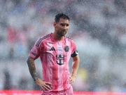 Messi chấn thương ngay trước thềm World Cup, cả Argentina nín thở
