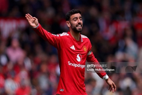 Pep lấy Bruno Fernandes làm “tấm gương tiêu cực”, răn dạy dàn sao Man City