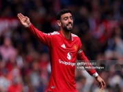 Pep lấy Bruno Fernandes làm “tấm gương tiêu cực”, răn dạy dàn sao Man City