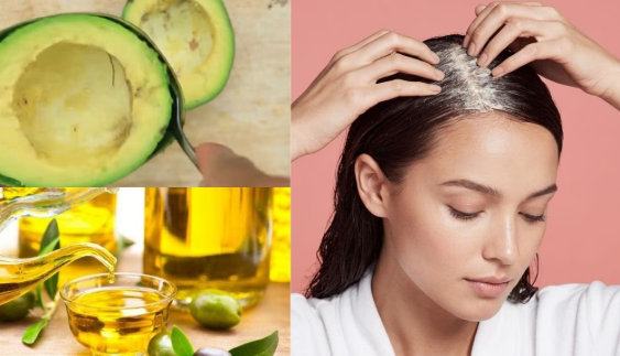 Nhờ chứa các axit béo thiết yếu (như omega-3, axit oleic), bơ bổ sung độ ẩm cần thiết, hỗ trợ cải thiện tình trạng so sợi tóc bị sần sùi, khô do thiếu nước.
