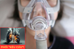Tin tức sức khỏe - 4 yếu tố khiến phổi dễ bị tổn thương khiến đàm ho dai dẳng, khó thở kéo dài