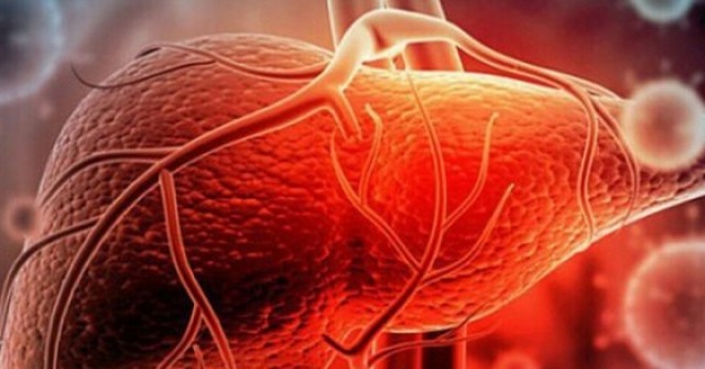 Người đàn ông 40 tuổi mắc ung thư gan vì thói quen nhiều người Việt đang làm mỗi ngày