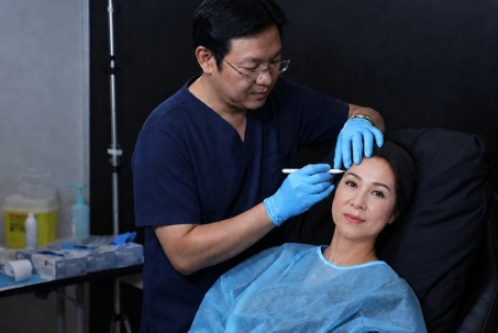 So sánh căng chỉ và nâng cơ nội sinh đa tầng Facial Lift tại Phòng Khám Thẩm Mỹ ARION