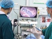 Mệt mỏi, sụt cân sau thời gian dài táo bón, người phụ nữ 48 tuổi nhận kết quả không ngờ