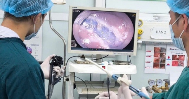 Mệt mỏi, sụt cân sau thời gian dài táo bón, người phụ nữ 48 tuổi nhận kết quả không ngờ