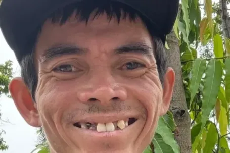 Tình trạng chàng trai chăn bò từng nổi tiếng toàn cầu