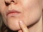 5 thói quen khiến da lão hóa nhanh hơn trong mùa hè