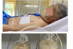 Hút ra hàng lít mủ từ phổi người đàn ông ở Đà Nẵng