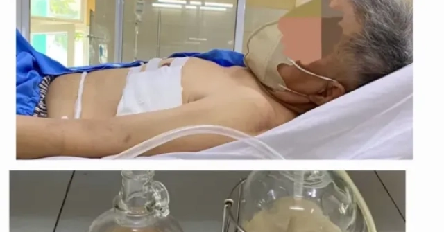 Hút ra hàng lít mủ từ phổi người đàn ông ở Đà Nẵng