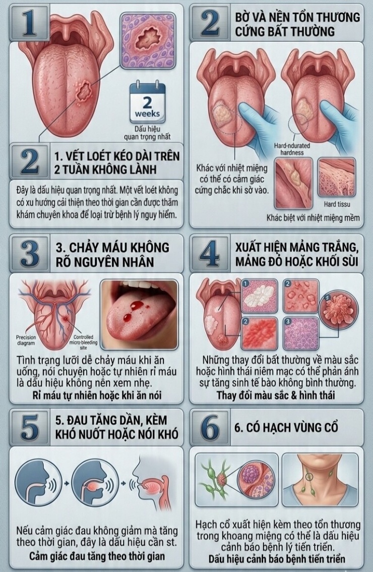 Vết loét kéo dài trên lưỡi có thể là dấu hiệu cảnh báo sớm của nhiều bệnh lý, cần được thăm khám kịp thời.