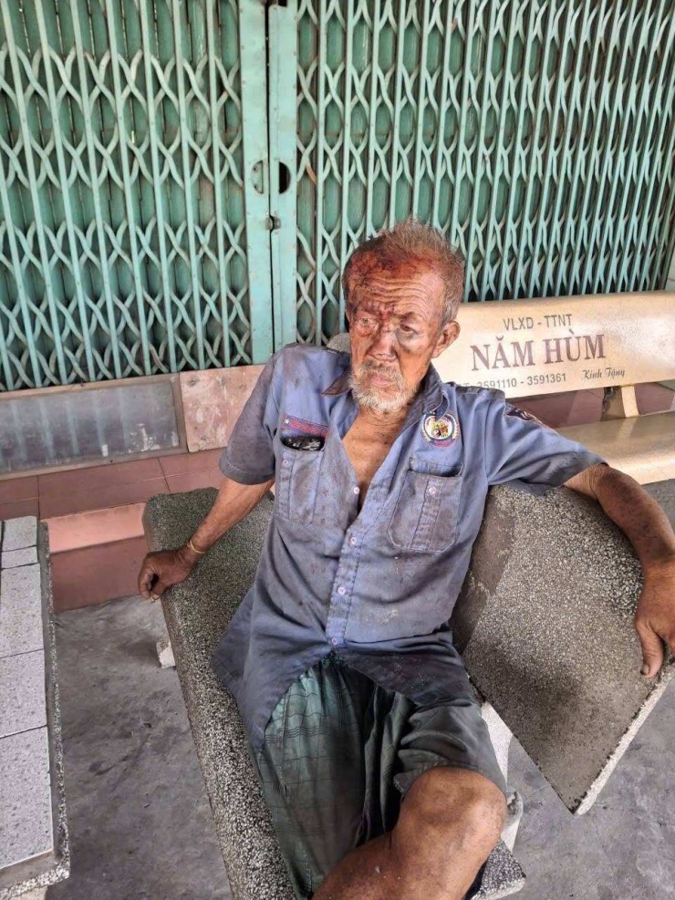Ông lão Nguyễn Văn Hòa (70 tuổi, ngụ ấp Bình Lương, xã Thủ Thừa, Tây Ninh) bán vé số và nhặt phế liệu bị đối tượng đánh, cướp tài sản; đầu, mặt còn nhiều vết thương. Ảnh: Thiên Long.