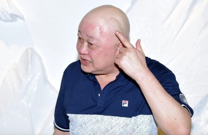 Nam diễn viên trải qua ca phẫu thuật u não khẩn cấp.