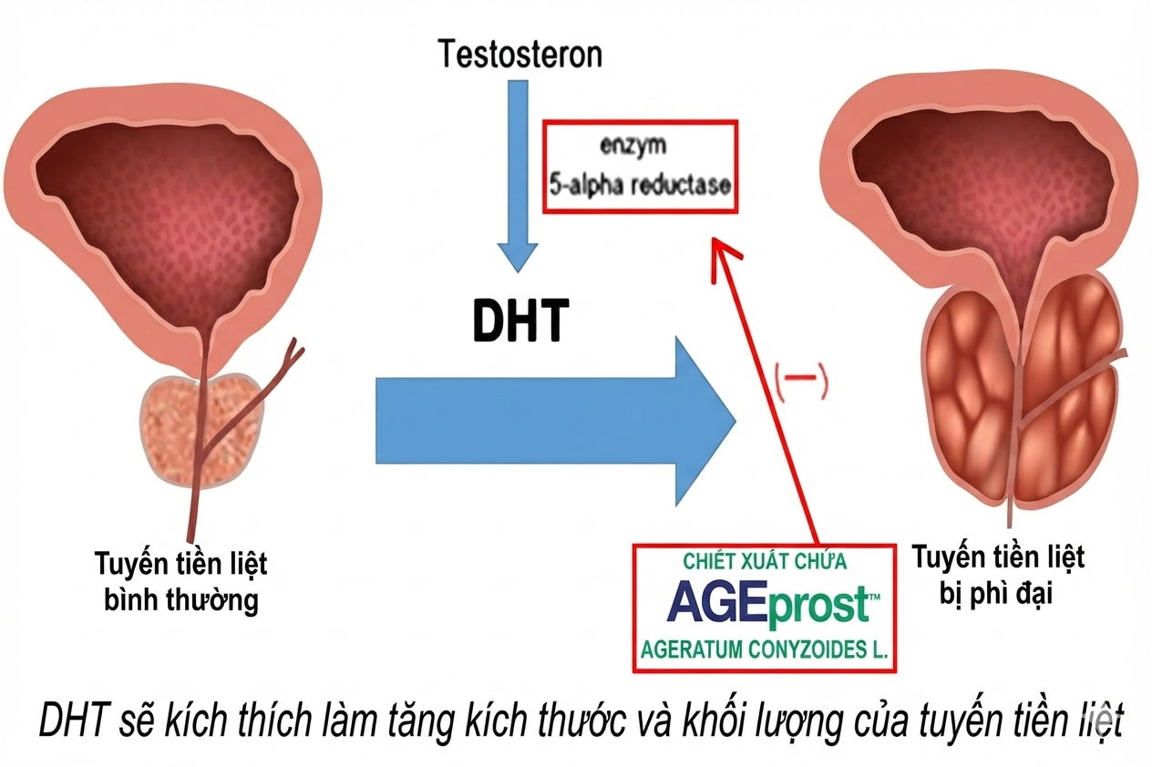 5 siêu thực phẩm giúp quý ông ngăn ngừa nguy cơ phì đại tiền liệt tuyến - 2
