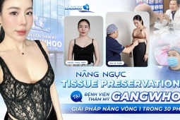 Nâng ngực Tissue Preservation tại Bệnh viện Thẩm mỹ Gangwhoo – Giải pháp nâng ngực trong 30 phút