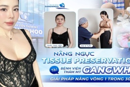 Nâng ngực Tissue Preservation tại Bệnh viện Thẩm mỹ Gangwhoo – Giải pháp nâng ngực trong 30 phút