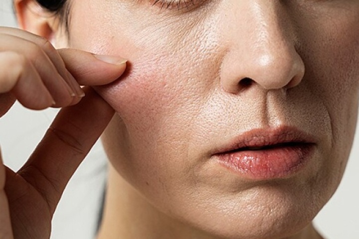 5 thói quen hàng ngày khiến collagen 'bốc hơi' nhanh hơn bạn tưởng