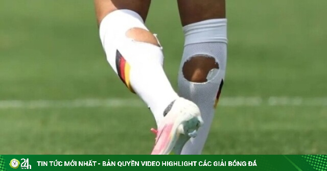 Vì sao cầu thủ World Cup 2026 đua nhau dùng tất rách?