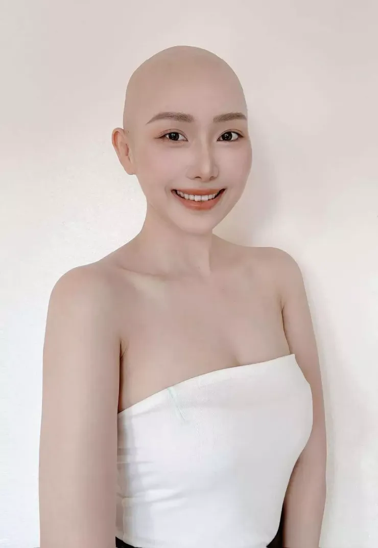 Minh Anh lạc quan trong quá trình chữa ung thư vú. Ảnh: NVCC
