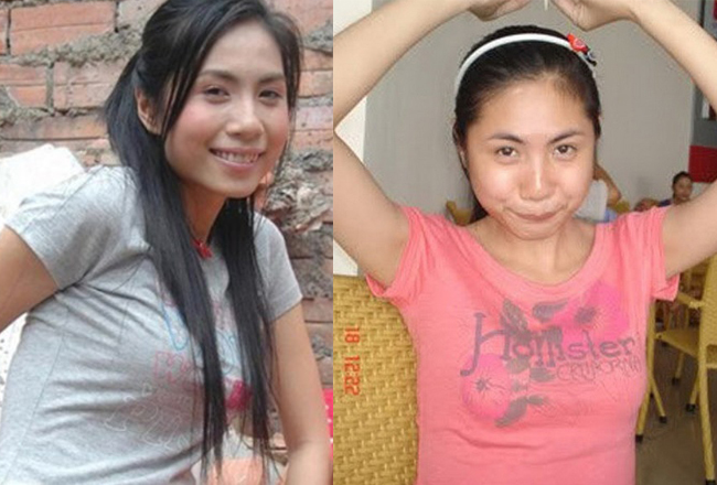 Thủy Tiên thời chưa phẫu thuật thẩm mỹ sở hữu làn da ngăm và gương mặt không mấy nổi bật.