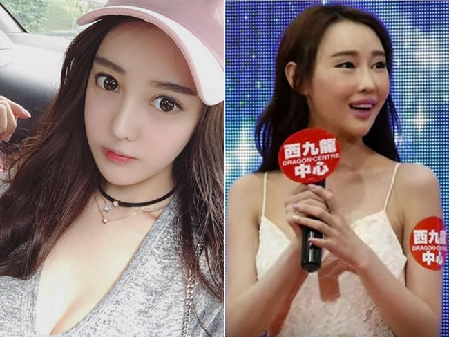 Kimmy Chichi là hot girl mạng nổi đình nổi đám tại Trung Quốc. Trên mạng xã hội, cô nàng xuất hiện với những hình ảnh lung linh, đôi mắt to tròn, làn da trắng nõn. Người hâm mộ cứ mãi xuýt xoa trước nhan sắc hơn người của Kimmy cho đến khi cô nàng xuất hiện trên sóng truyền hình.&nbsp;